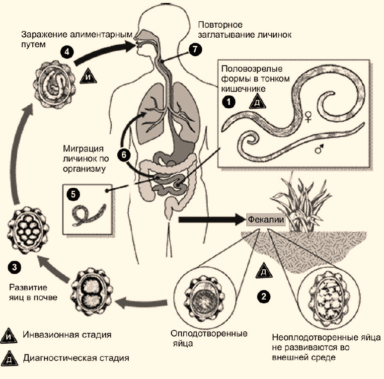 Болезнь аскаридоз и воздействие паразита