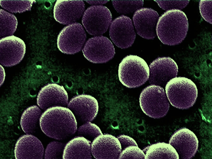 Лечение сапрофитного стафилококка и как избавиться от микроба